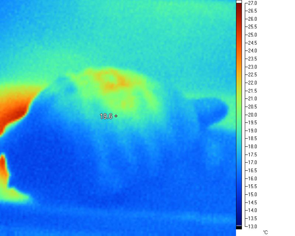 Localised overheating while extremeties
                        remain cold